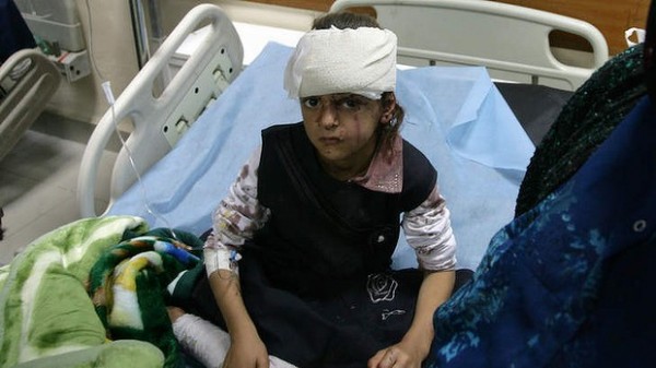 131006-iraq-victim-injured-by-suicide-bombers-2
